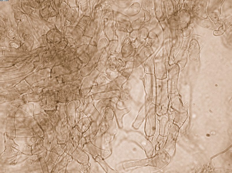 Coprinopsis strossmayeri (Schulzer) Redhead et al.